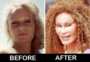 Catwoman-Jocelyn-Wildenstein-before-after-plastic-surgery-photos ...