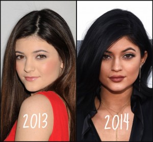 Kylie-Jenner-before-and-after-lips-2013-2014