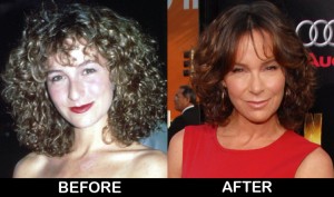 jennifer-grey-before-after-plastic-surgery-photos