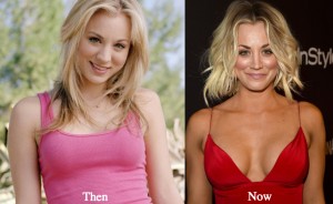 http://latestplasticsurgery.com/kaley-cuoco-plastic-surgery-before-and-after-photos/